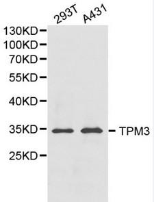 TPM3 Antibody - Western blot of TPM3 pAb in extracts from 293T and A431 cells.