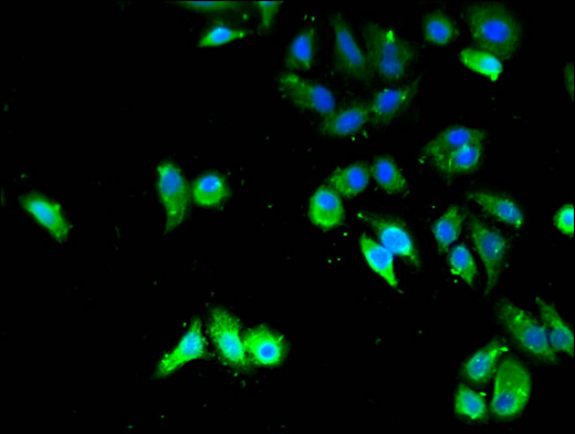 TPM3 Antibody - Immunofluorescent analysis of HepG2 cells using TPM3 Antibody at a dilution of 1:100 and Alexa Fluor 488-congugated AffiniPure Goat Anti-Rabbit IgG(H+L)