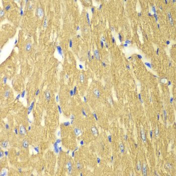 TPM3 Antibody - Immunohistochemistry of paraffin-embedded mouse heart using TPM3 antibody at dilution of 1:100 (40x lens).