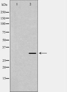 TPM3 Antibody - Western blot analysis of 293T cells using TPM3 antibody. The lane on the left is treated with the antigen-specific peptide.