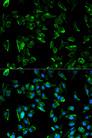 TPM3 Antibody - Immunofluorescence analysis of HeLa cells using TPM3 Polyclonal Antibody.