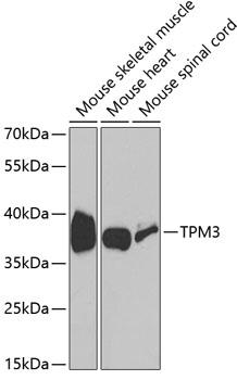 TPM3 Antibody - Western blot analysis of extracts of various cell lines using TPM3 Polyclonal Antibody at dilution of 1:1000.
