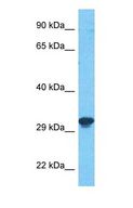 TPM4 Antibody - Western blot of TPM4 Antibody with human MCF7 Whole Cell lysate.  This image was taken for the unconjugated form of this product. Other forms have not been tested.