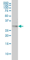 TPM4 Antibody - TPM4 monoclonal antibody (M01), clone 4E4-1D2 Western blot of TPM4 expression in HeLa.