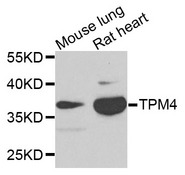 TPM4 Antibody - Western blot analysis of extracts of various cells.