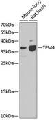 TPM4 Antibody - Western blot analysis of extracts of various cell lines using TPM4 Polyclonal Antibody at dilution of 1:1000.