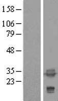 TPM4 Protein - Western validation with an anti-DDK antibody * L: Control HEK293 lysate R: Over-expression lysate