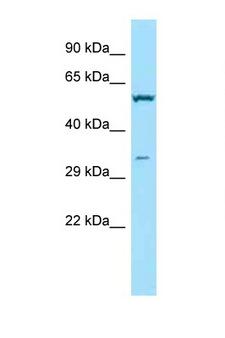 TPMT Antibody - TPMT antibody Western blot of 3 Cell lysate. Antibody concentration 1 ug/ml.  This image was taken for the unconjugated form of this product. Other forms have not been tested.