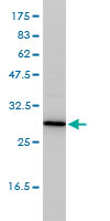 TPMT Antibody - TPMT monoclonal antibody (M01), clone 1B5 Western blot of TPMT expression in Jurkat.
