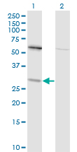 TPMT Antibody - Western blot of TPMT expression in transfected 293T cell line by TPMT monoclonal antibody (M01), clone 1B5.