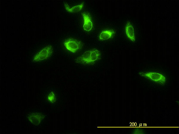TPMT Antibody - Immunofluorescence of monoclonal antibody to TPMT on HeLa cell. [antibody concentration 10 ug/ml]