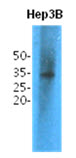 TPMT Antibody - Western Blot: The cell lysates (40 ug) were resolved by SDS-PAGE, transferred to PVDF membrane and probed with anti-human TPMT antibody (1:1,000). Proteins were visualized using a goat anti-mouse secondary antibody conjugated to HRP and an ECL detection system.