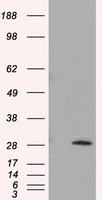 TPMT Antibody - HEK293T cells were transfected with the pCMV6-ENTRY control (Left lane) or pCMV6-ENTRY TPMT (Right lane) cDNA for 48 hrs and lysed. Equivalent amounts of cell lysates (5 ug per lane) were separated by SDS-PAGE and immunoblotted with anti-TPMT.
