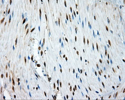 TPMT Antibody - IHC of paraffin-embedded colon tissue using anti-TPMT mouse monoclonal antibody. (Dilution 1:50).