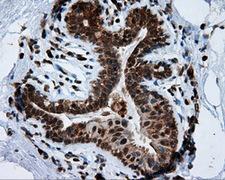 TPMT Antibody - IHC of paraffin-embedded breast tissue using anti-TPMT mouse monoclonal antibody. (Dilution 1:50).
