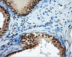 TPMT Antibody - IHC of paraffin-embedded prostate tissue using anti-TPMT mouse monoclonal antibody. (Dilution 1:50).