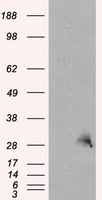 TPMT Antibody - HEK293T cells were transfected with the pCMV6-ENTRY control (Left lane) or pCMV6-ENTRY TPMT (Right lane) cDNA for 48 hrs and lysed. Equivalent amounts of cell lysates (5 ug per lane) were separated by SDS-PAGE and immunoblotted with anti-TPMT.