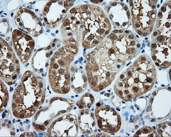 TPMT Antibody - IHC of paraffin-embedded Kidney tissue using anti-TPMT mouse monoclonal antibody. (Dilution 1:50).