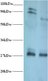 TPMT Antibody - Western blot of Thiopurine S-methyltransferase antibody at 2 ug/ml. Lane 1: EC109 whole cell lysate. Lane 2: 293T whole cell lysate. Secondary: Goat polyclonal to Rabbit IgG at 1:15000 dilution. Predicted band size: 27 kDa. Observed band size: 27 kDa Additional bands at: 90 kDa, 100 kDa. We are unsure as to the identity of these extra bands.  This image was taken for the unconjugated form of this product. Other forms have not been tested.
