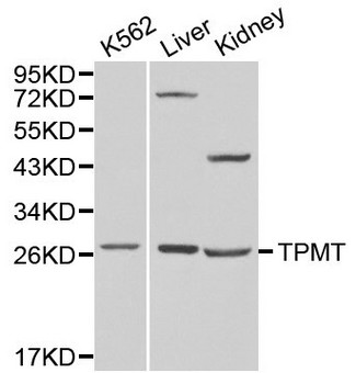 TPMT Antibody - Western blot of TPMT pAb in extracts from K562 cells and mouse liver, kidney tissues.