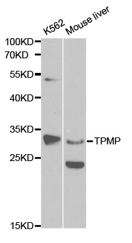 TPMT Antibody - Western blot analysis of extracts of various cell lines.