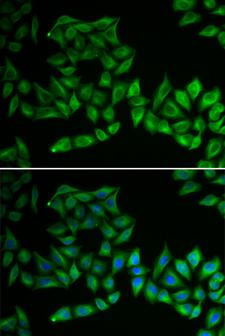 TPMT Antibody - Immunofluorescence analysis of U2OS cells using TPMT antibody. Blue: DAPI for nuclear staining.