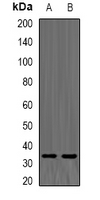 TPMT Antibody - Western blot analysis of TPMT expression in K562 (A); mouse liver (B) whole cell lysates.