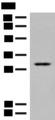 TPMT Antibody - Western blot analysis of Human kidney tissue lysate  using TPMT Polyclonal Antibody at dilution of 1:400