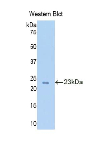 TPO / Thyroid Peroxidase Antibody - Western blot of recombinant TPO / Thyroid Peroxidase.  This image was taken for the unconjugated form of this product. Other forms have not been tested.