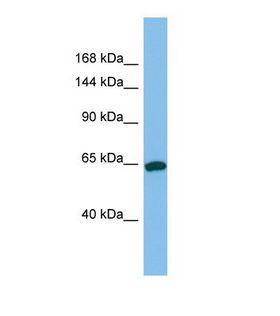 TPO / Thyroid Peroxidase Antibody - Western blot of Human Jurkat. TPO antibody dilution 1.0 ug/ml.  This image was taken for the unconjugated form of this product. Other forms have not been tested.