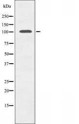 TPO / Thyroid Peroxidase Antibody - Western blot analysis of TPO using HuvEc whole cells lysates