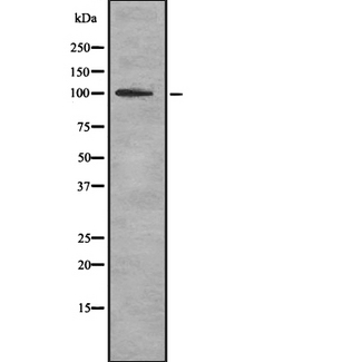 TPO / Thyroid Peroxidase Antibody - Western blot analysis of TPO using HuvEc whole cells lysates