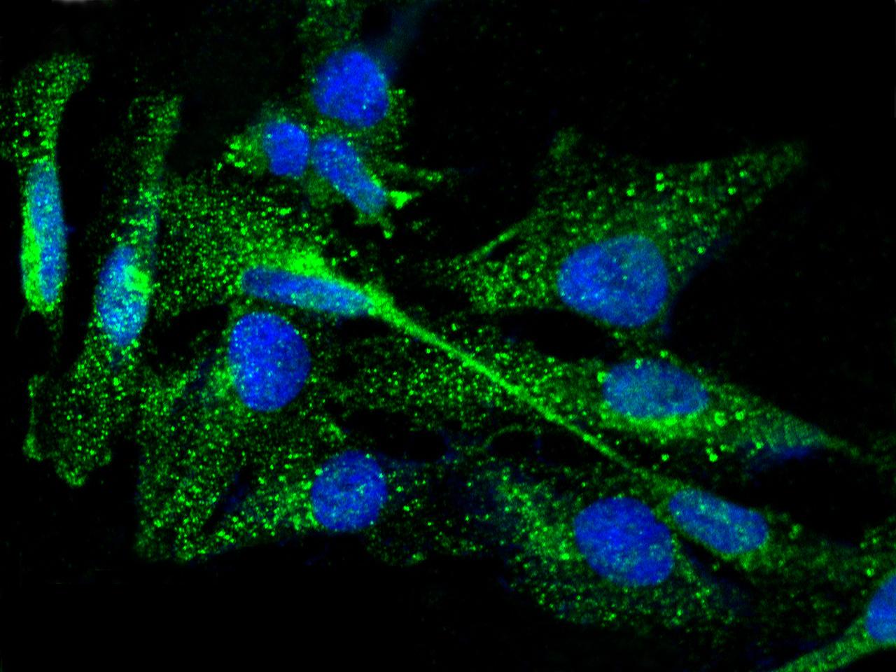 Anti-TPO / Thyroid Peroxidase Antibody | Rabbit anti-Human | LSBio