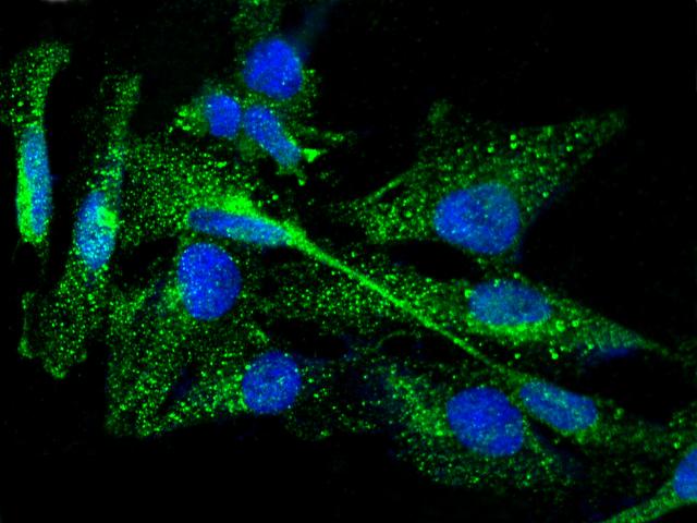 TPO / Thyroid Peroxidase Antibody - Immunofluorescence staining of TPO in U251MG cells. Cells were fixed with 4% PFA, permeabilzed with 0.3% Triton X-100 in PBS, blocked with 10% serum, and incubated with rabbit anti-Human TPO polyclonal antibody (dilution ratio 1:1000) at 4°C overnight. Then cells were stained with the Alexa Fluor 488-conjugated Goat Anti-rabbit IgG secondary antibody (green) and counterstained with DAPI (blue). Positive staining was localized to cytoplasm.