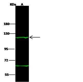 TPO / Thyroid Peroxidase Antibody - Anti-TPO rabbit polyclonal antibody at 1:500 dilution. Lane A: Jurkat Whole Cell Lysate. Lysates/proteins at 30 ug per lane. Secondary: Goat Anti-Rabbit IgG H&L (Dylight 800) at 1/10000 dilution. Developed using the Odyssey technique. Performed under reducing conditions. Predicted band size: 103 kDa. Observed band size: 123 kDa.