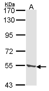 TPP1 / CLN2 Antibody - Sample (30 ug of whole cell lysate). A: A431 . 7.5% SDS PAGE. CLN2 antibody. TPP1 / CLN2 antibody diluted at 1:1000.