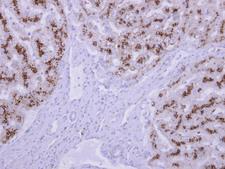 TPP1 / CLN2 Antibody - TPP1 antibody detects TPP1 protein at cytosol on normal liver by immunohistochemical analysis. Sample: Paraffin-embedded normal liver. TPP1 antibody dilution:1:500.