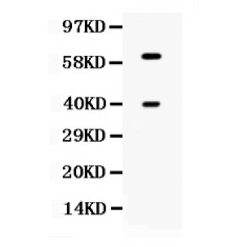TPP1 / CLN2 Antibody - Western blot analysis of TPP1 expression in HELA whole cell lysates (lane 1). TPP1 at 61 kD, 39 kD was detected using rabbit anti- TPP1 Antigen Affinity purified polyclonal antibody at 0.5 ug/mL. The blot was developed using chemiluminescence (ECL) method.