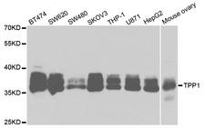 TPP1 / CLN2 Antibody - Western blot analysis of extracts of various cell lines.