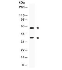 TPP1 / CLN2 Antibody