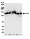 TPP2 Antibody - Detection of human and mouse TPP2 by western blot. Samples: Whole cell lysate (50 µg) from HeLa, HEK293T, Jurkat, mouse TCMK-1, and mouse NIH 3T3 cells prepared using NETN lysis buffer. Antibodies: Affinity purified rabbit anti-TPP2 antibody used for WB at 0.1 µg/ml. Detection: Chemiluminescence with an exposure time of 10 seconds.