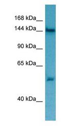 TPP2 Antibody - TPP2 antibody Western Blot of Jurkat.  This image was taken for the unconjugated form of this product. Other forms have not been tested.