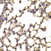 TPP2 Antibody - Immunohistochemistry of paraffin-embedded Mouse lung tissue.