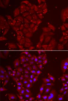 TPP2 Antibody - Immunofluorescence analysis of U2OS cells.