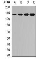 TPP2 Antibody - Western blot analysis of TPP2 expression in Jurkat (A); SW620 (B); mouse brain (C); mouse spleen (D) whole cell lysates.