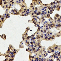 TPP2 Antibody - Immunohistochemical analysis of TPP2 staining in mouse lung formalin fixed paraffin embedded tissue section. The section was pre-treated using heat mediated antigen retrieval with sodium citrate buffer (pH 6.0). The section was then incubated with the antibody at room temperature and detected using an HRP conjugated compact polymer system. DAB was used as the chromogen. The section was then counterstained with hematoxylin and mounted with DPX.