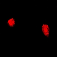 TPP2 Antibody - Immunofluorescent analysis of TPP2 staining in U2OS cells. Formalin-fixed cells were permeabilized with 0.1% Triton X-100 in TBS for 5-10 minutes and blocked with 3% BSA-PBS for 30 minutes at room temperature. Cells were probed with the primary antibody in 3% BSA-PBS and incubated overnight at 4 deg C in a humidified chamber. Cells were washed with PBST and incubated with a DyLight 594-conjugated secondary antibody (red) in PBS at room temperature in the dark.