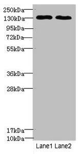 TPP2 Antibody - Western blot All Lanes: TPP2antibody at 3.42ug/ml Lane 1 : Hela whole cell lysate Lane 2 : HepG-2 whole cell lysate Secondary Goat polyclonal to Rabbit IgG at 1/10000 dilution Predicted band size: 138 kDa Observed band size: 138 kDa