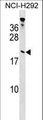 TPPP Antibody - TPPP Antibody western blot of NCI-H292 cell line lysates (35 ug/lane). The TPPP antibody detected the TPPP protein (arrow).