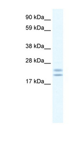 TPPP Antibody - TPPP antibody ARP37600_T100-NP_878259-2900041A09RIK Antibody Western blot of Frontal cortex lysate.  This image was taken for the unconjugated form of this product. Other forms have not been tested.